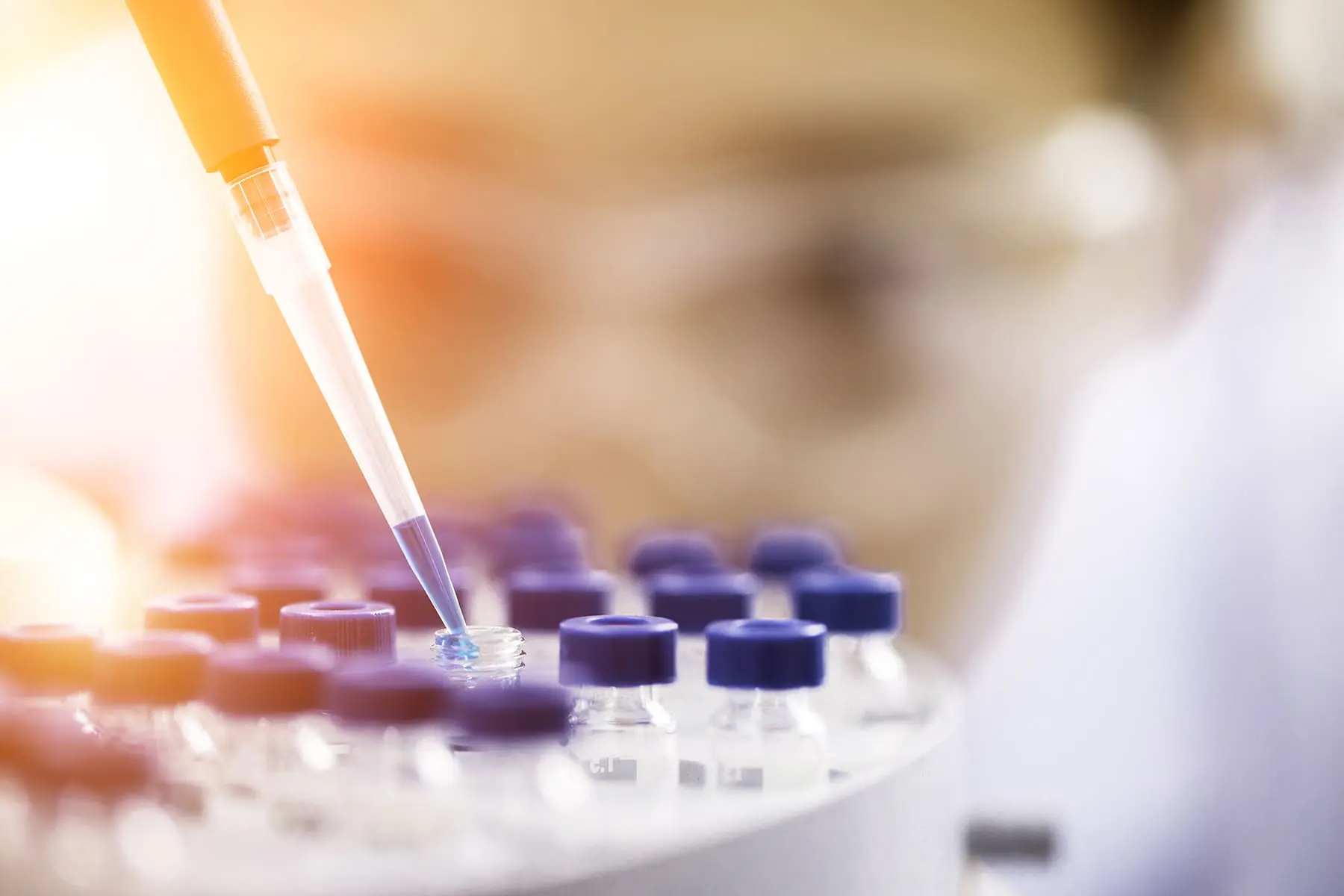 A pipette is dispensing a liquid into a well of a microtiter plate with a blurred laboratory background.